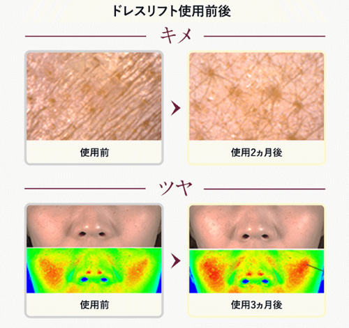 アテニア お試しセット1200円!ドレスリフトハリ肌化粧水セット 2 アテニア ドレスリフト 効果