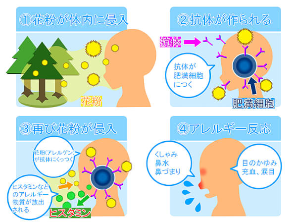 花粉症の症状と花粉対策